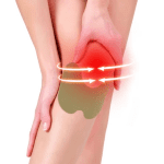 Knee Patch - imagine 3